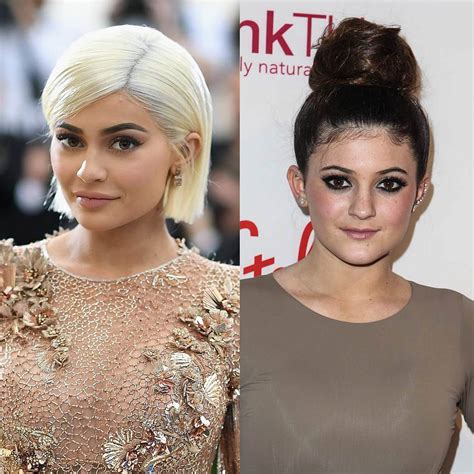 kylie vorher nachher|Kaum wiederzuerkennen: Wie Kylie Jenner vor ihren Beauty